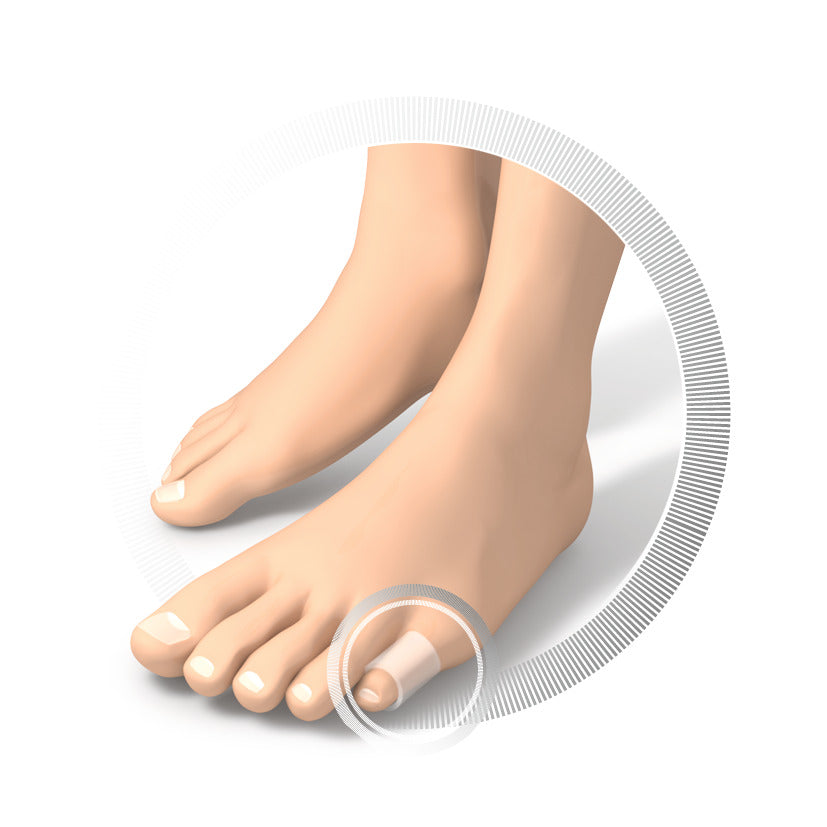 Protection pour orteil en gel - Bague pour le petit orteil - 4 pièces - Ruck