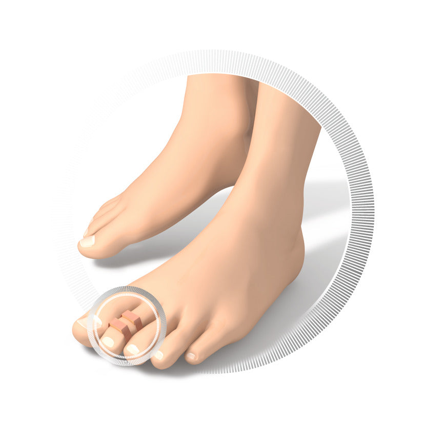 Protection pour orteil - 9 pièces - Deux épaisseurs disponibles