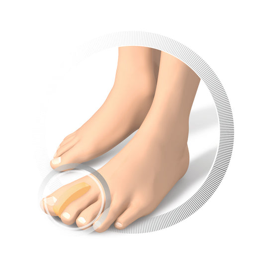 Séparateur d'orteils - 3 pièces - 3 tailles disponibles - Ruck